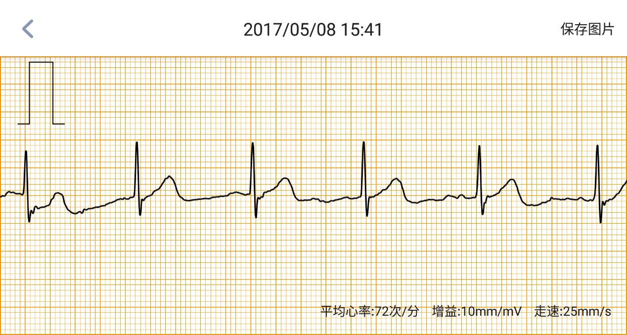 母亲节送啥？米动健康手环超值首选